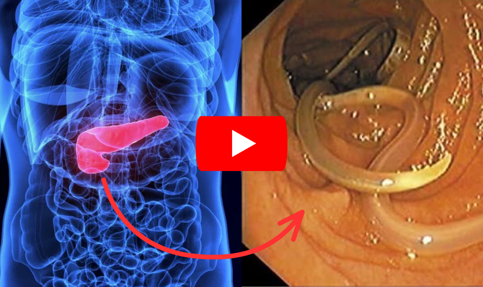 Harvard Pancreas Parasite Experiment